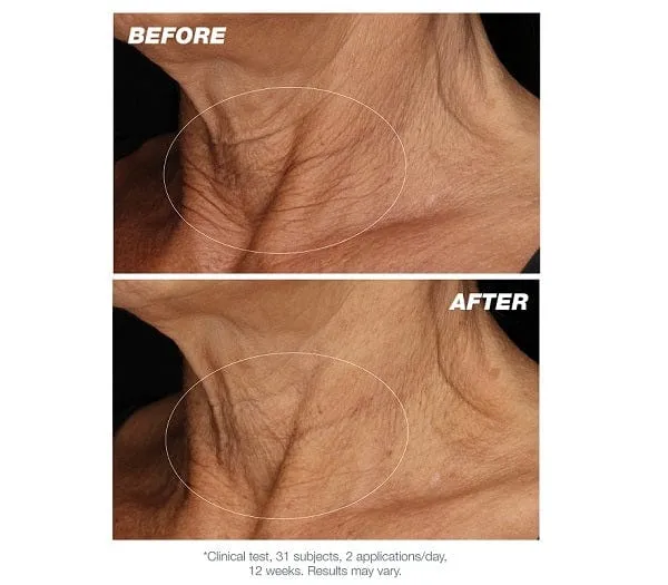 Neck Fit Contour Serum